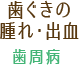 歯ぐきの腫れ・出血：歯周病