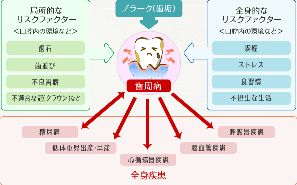 歯周病がもたらす悪影響